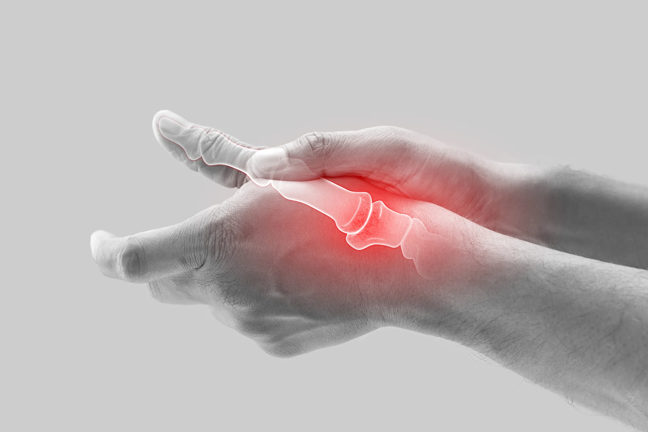Arthritis Treatment in Bangalore